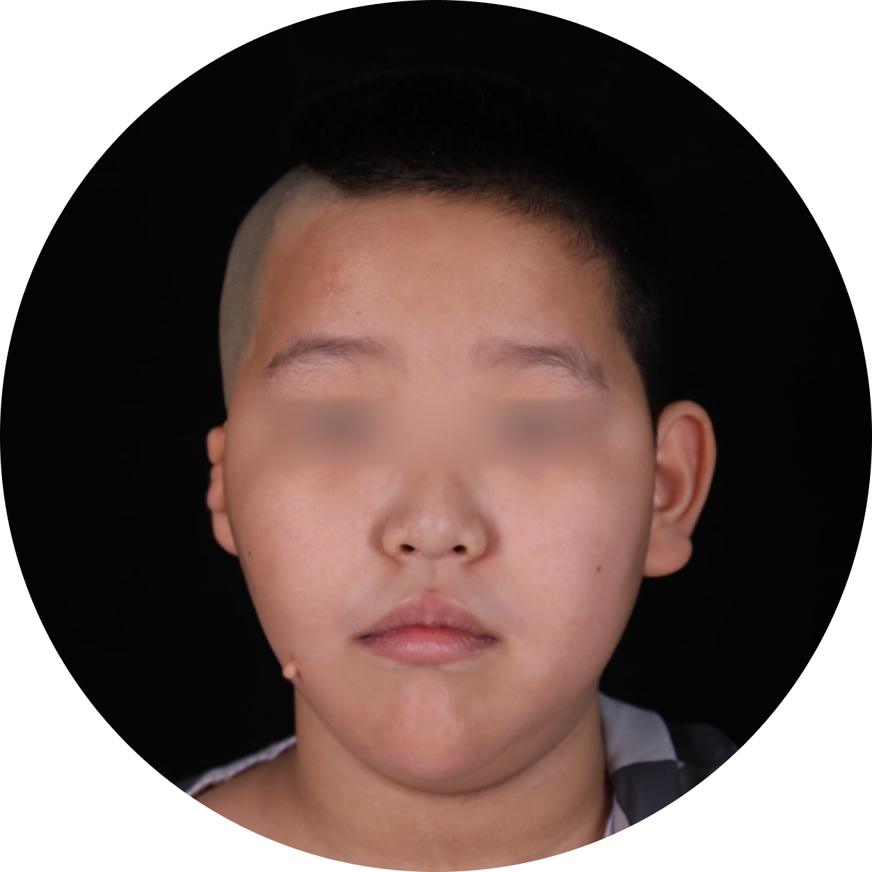 smallPic1